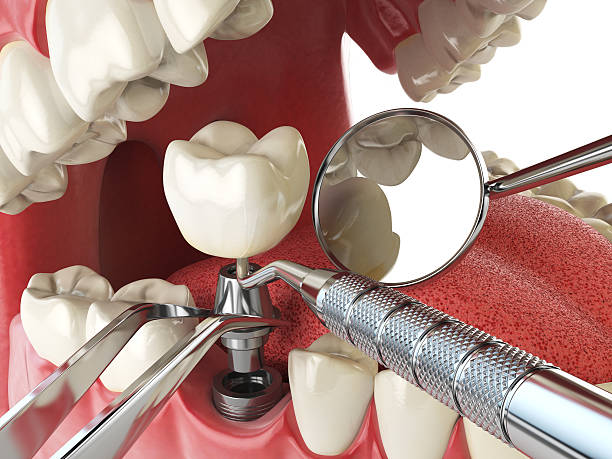 Best Same-Day Emergency Dental Services in Lewisburg, OH